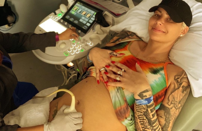 Amber Rose Pregnant