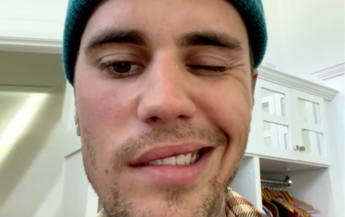 Justin Bieber Facial Paralysis