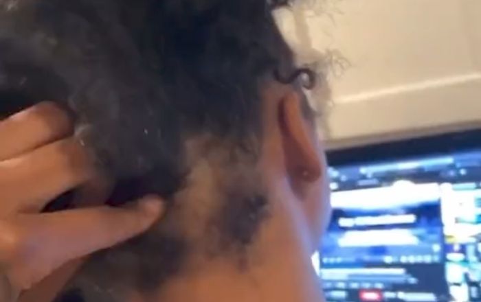Blueface Shares ChriseanRock Bald Spot