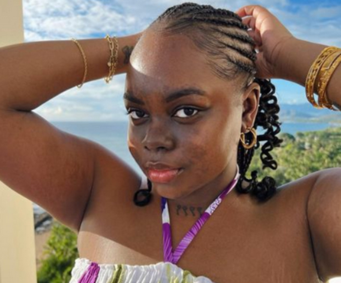 Cori Broadus Battles Stage 3 Lupus